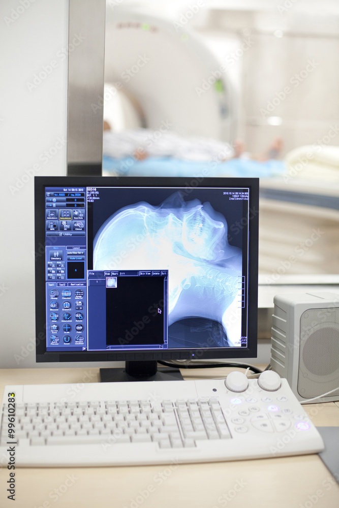 Patient having a CAT scan