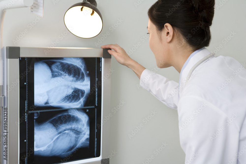 Doctor examining an X-ray