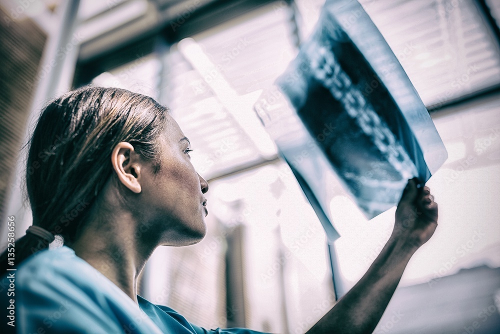 Nurse examining X-ray report