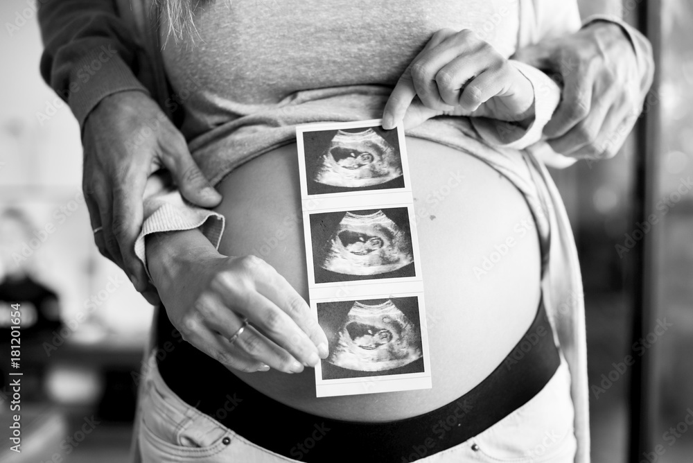 Pregnant woman and babys photo