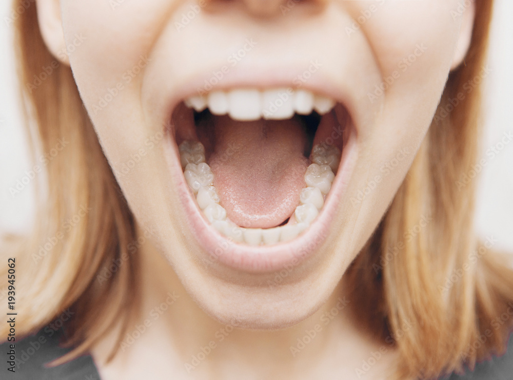 Denti, bocca di donna aperta con denti bianchi