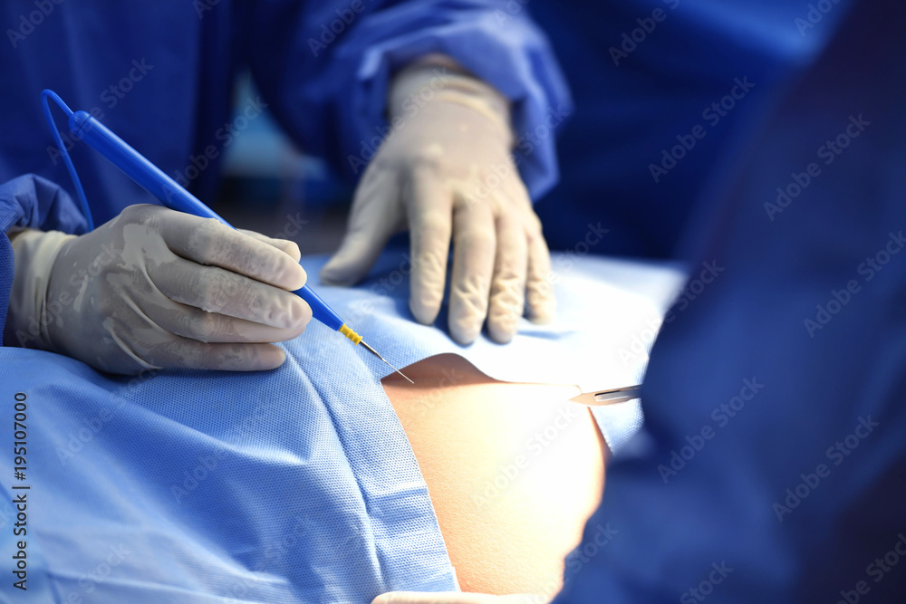 Team surgeon at work on operating room in hospital