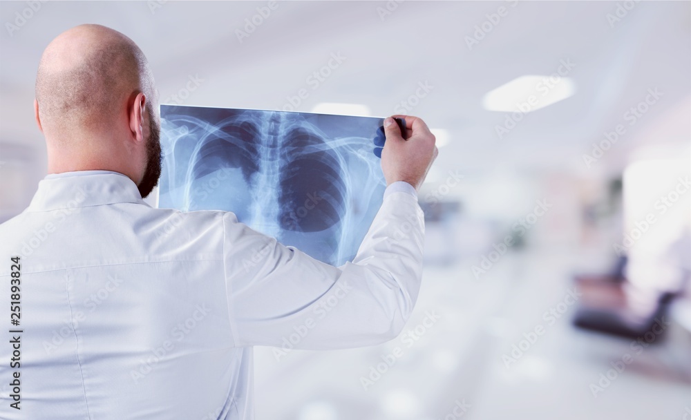 Young male doctor examining x-ray on white