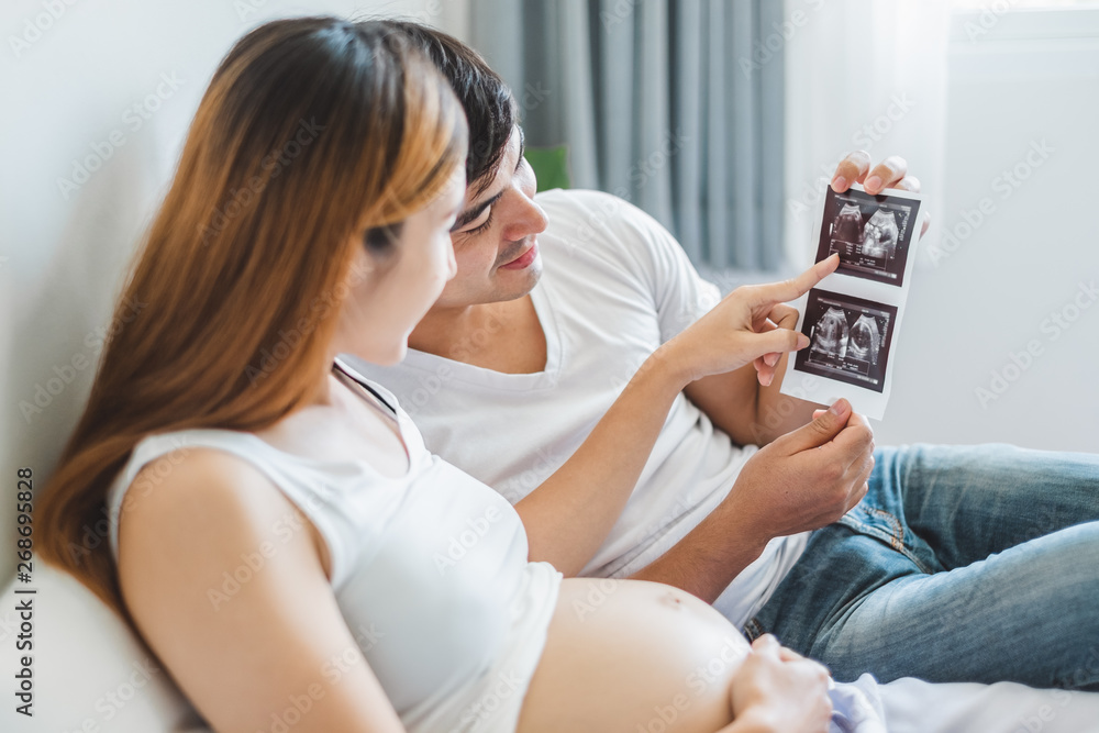 年轻的亚洲夫妇在白色床上拿着婴儿的超声波胶片