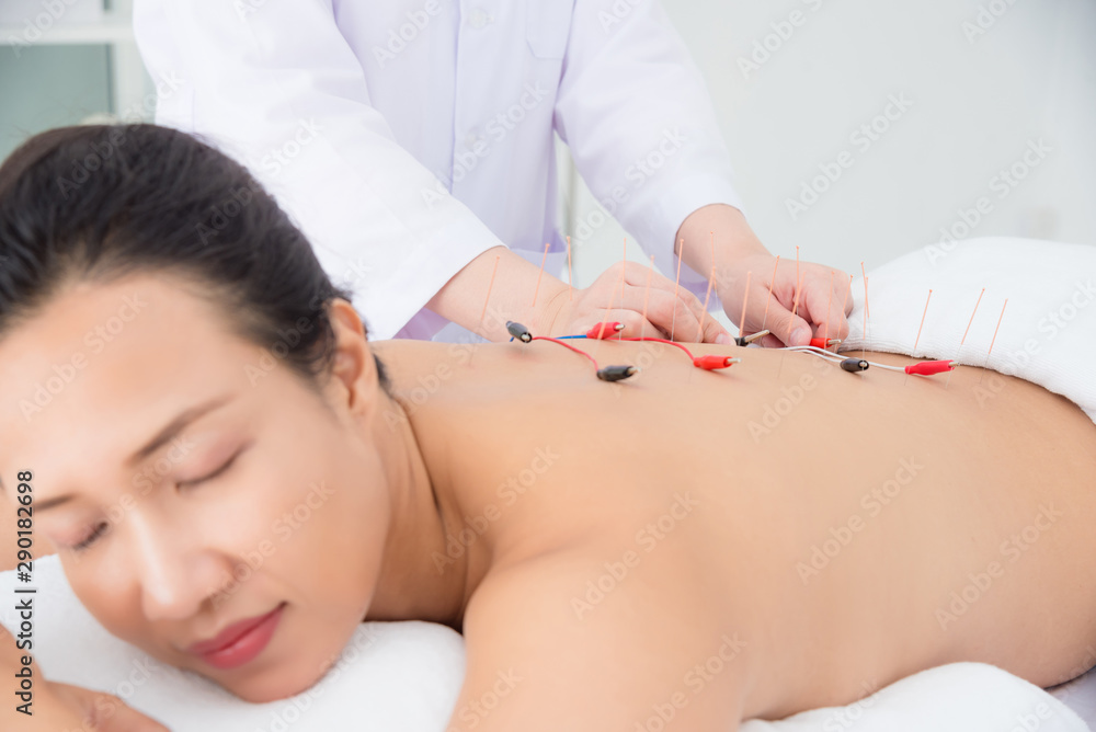 Beautiful asian woman receiving back acupuncture with electrical stimulator at clinic ,Alternative m