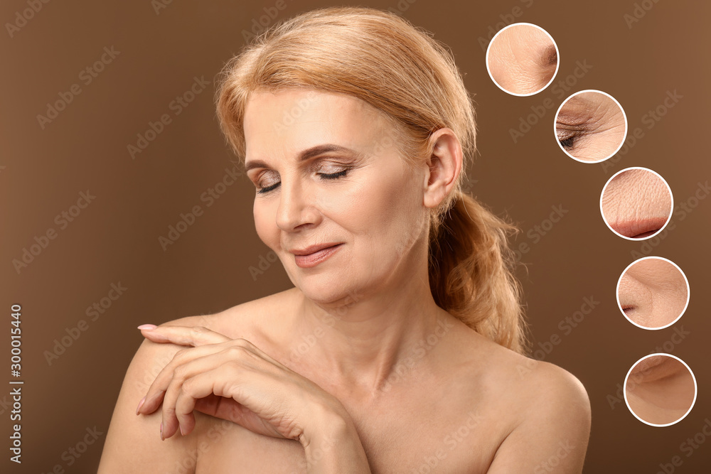 Portrait of beautiful mature woman with skin problem on color background. Process of aging