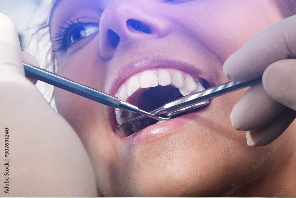 Woman teeth and a dentist mouth mirror on background