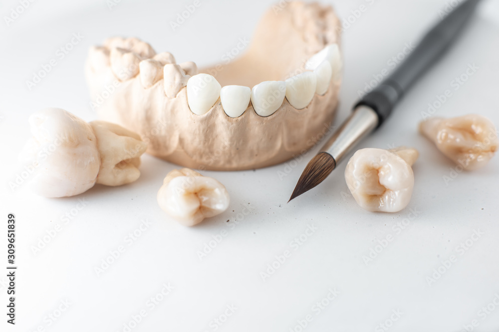 Close-up on plaster model of artificial jaw with teeth and paintbrush on the white background. Conce