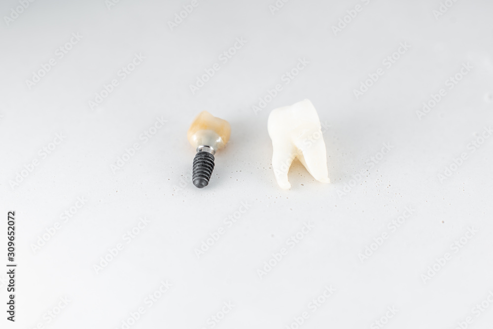 Macro shot of normal tooth and implant on the white background