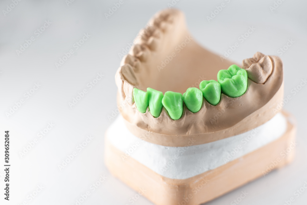 白色背景上涂有绿色牙齿的人工颌石膏模型特写。Con
