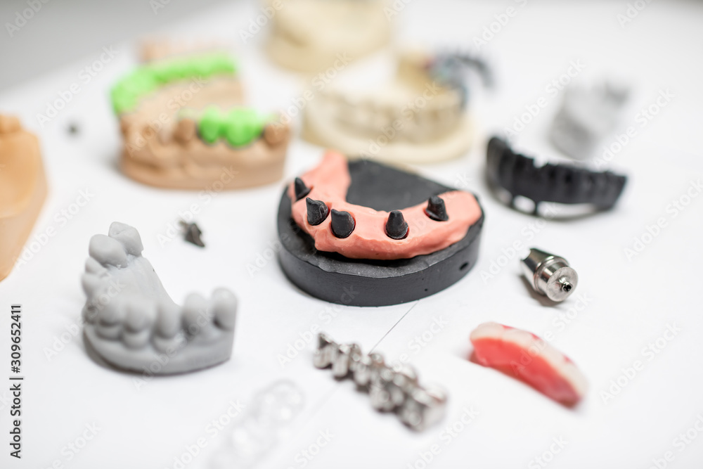 Various of artificial jaw models with dental implants and crowns on the white background. Concept of