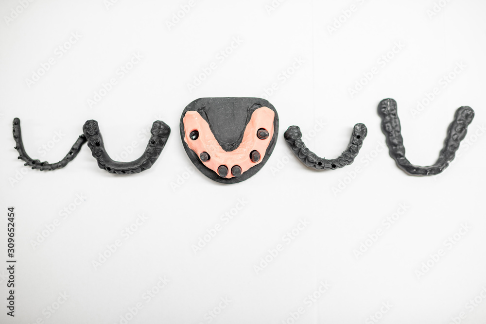 Artificial jaw with crowns and frame for dental implants on the white background, flat lay compositi