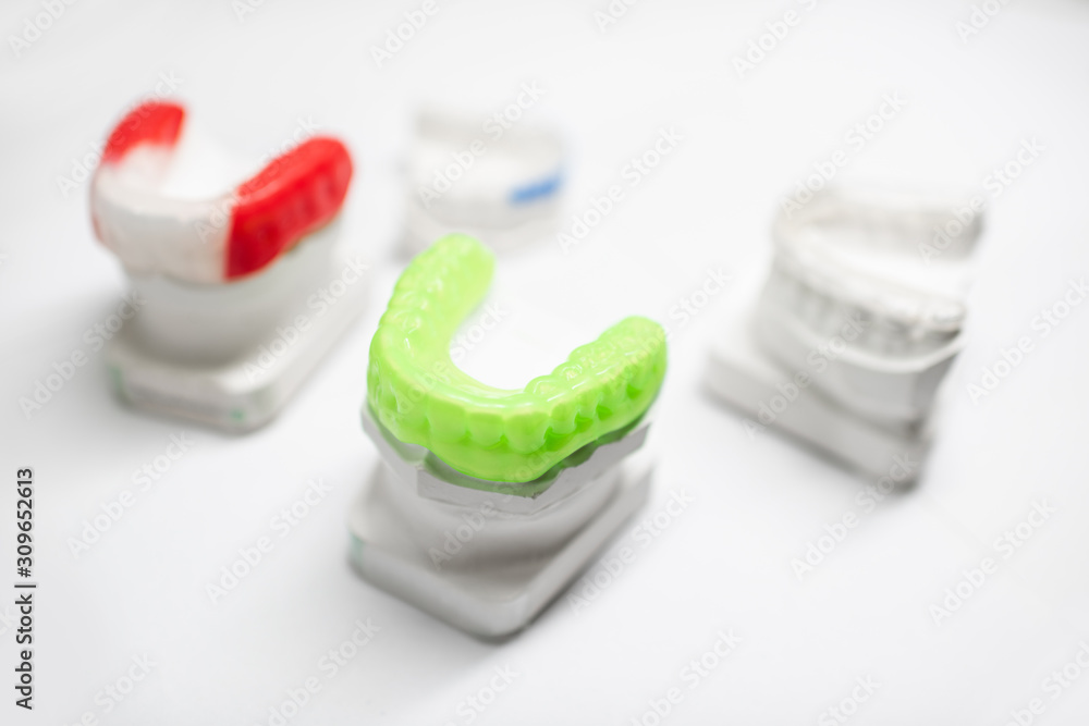 Gypsum models of artificial jaw with dental caps on the white background. Orthodontic caps and boxin