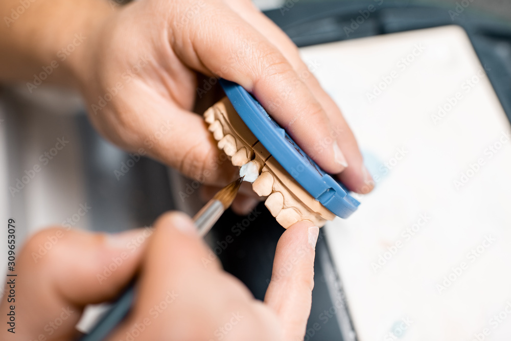 Dental technician coloring dental prosthesis with a paint brush at the laboratory, close-up view. Co