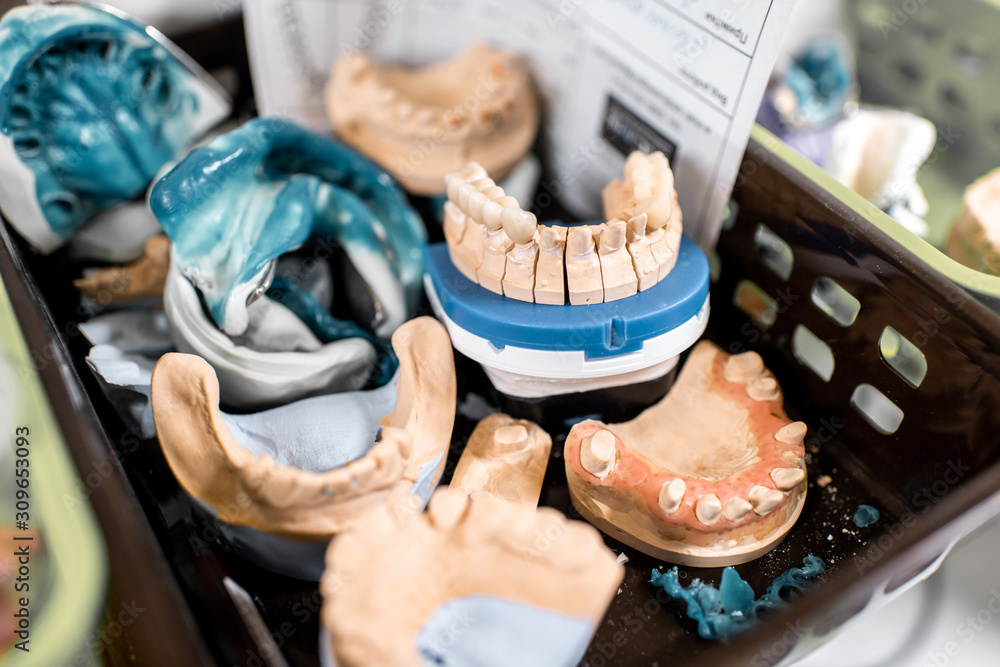 Various of artificial jaw models, impressions and dental implants on the shelves at the laboratory