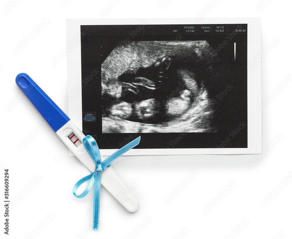 Pregnancy test and sonogram image on white background