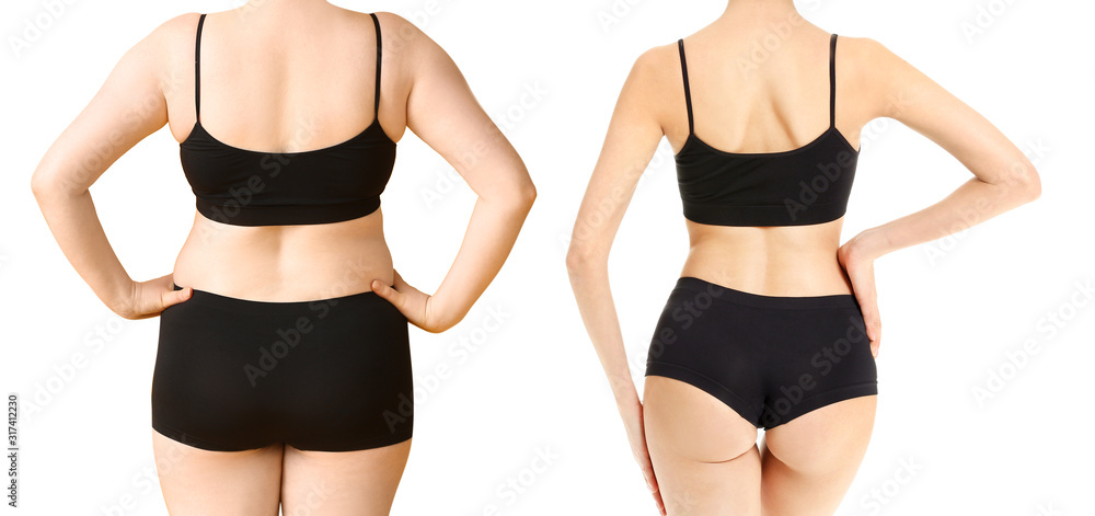 Young woman before and after weight loss on white background