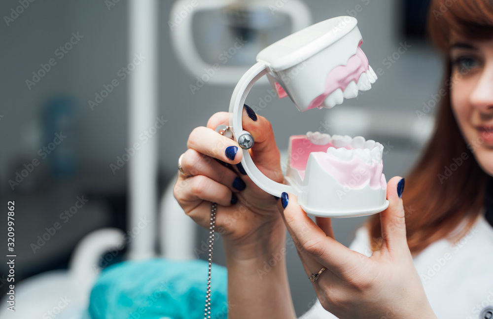 The doctor holds dental implants in hands. Plastic jaw in the dentists office. Close Up.