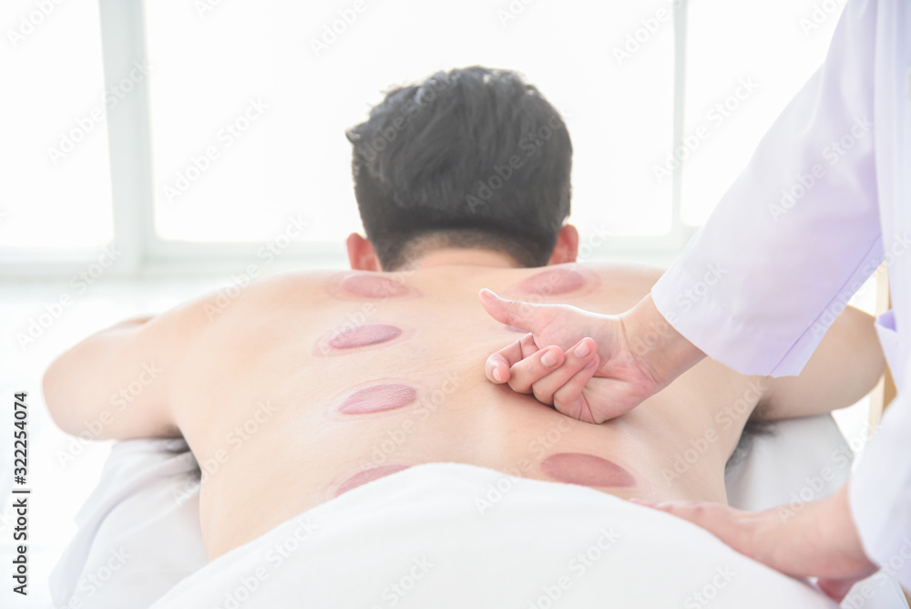 Therapist doing Tui na massage for her patient after cupping therapy finished ,Chinese alternative m