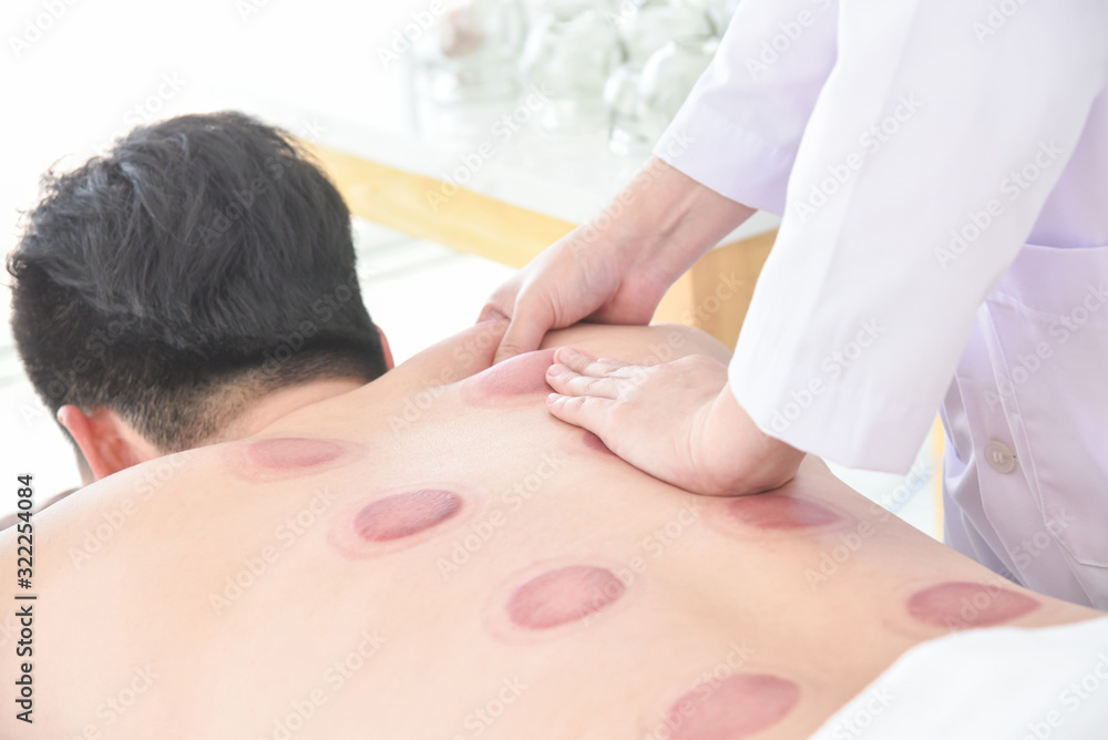 Therapist doing Tui na massage for her patient after cupping therapy finished ,Chinese alternative m