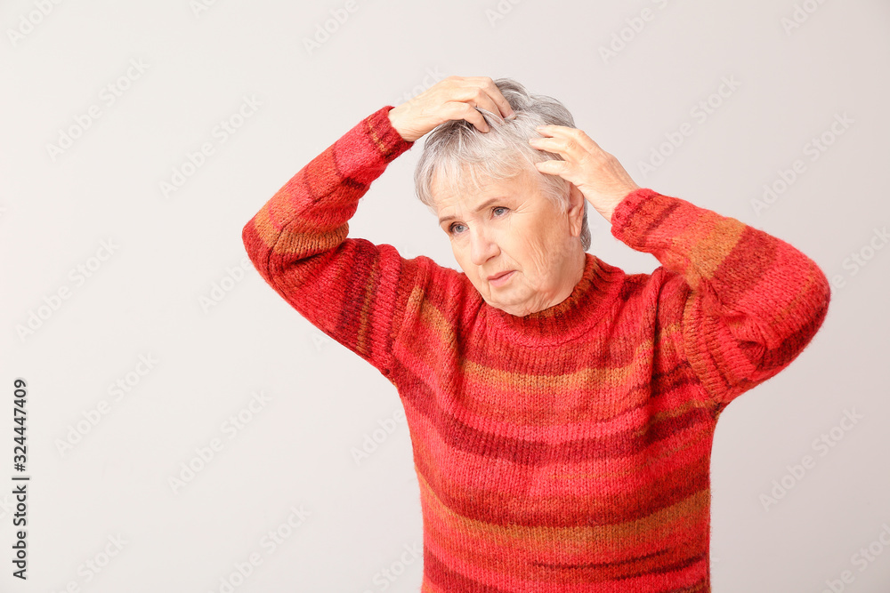 Senior woman with hair loss problem on light background