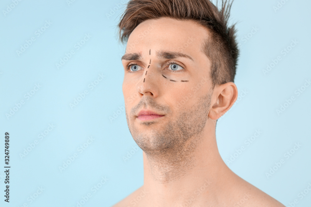 Young man with marks on his face against color background. Concept of plastic surgery