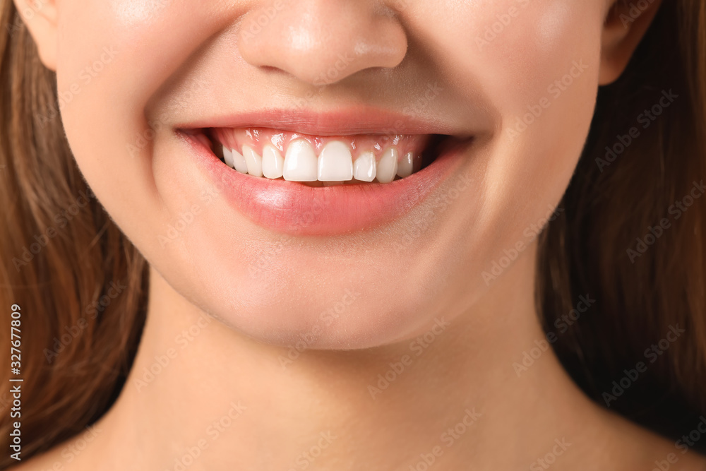 Young woman with healthy gums, closeup