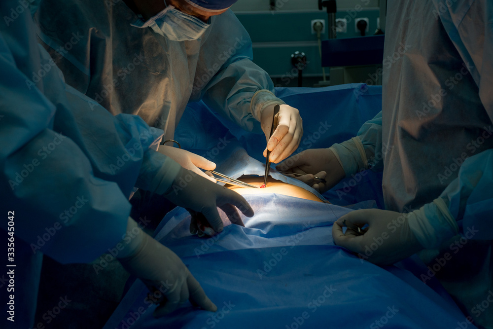 surgeon and assistants perform an operation on the human body. Doctor sutures