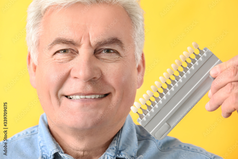 Senior man with teeth color samples on yellow background