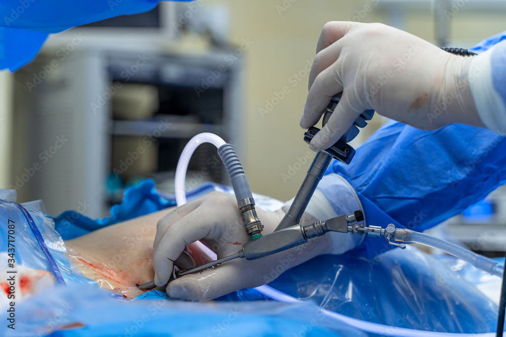 Surgery. Surgeon is operating with special equipment. Doctor`s hands closeup. Modern medical backgro