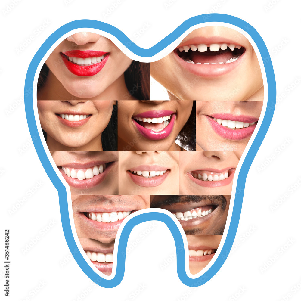 白色背景下不同微笑人群的牙齿形状