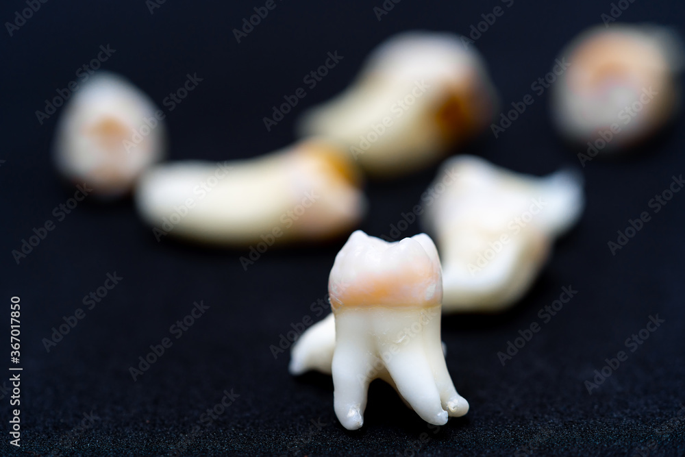 Beautiful ceramic teeth on the front view. Blurred background. Black background.