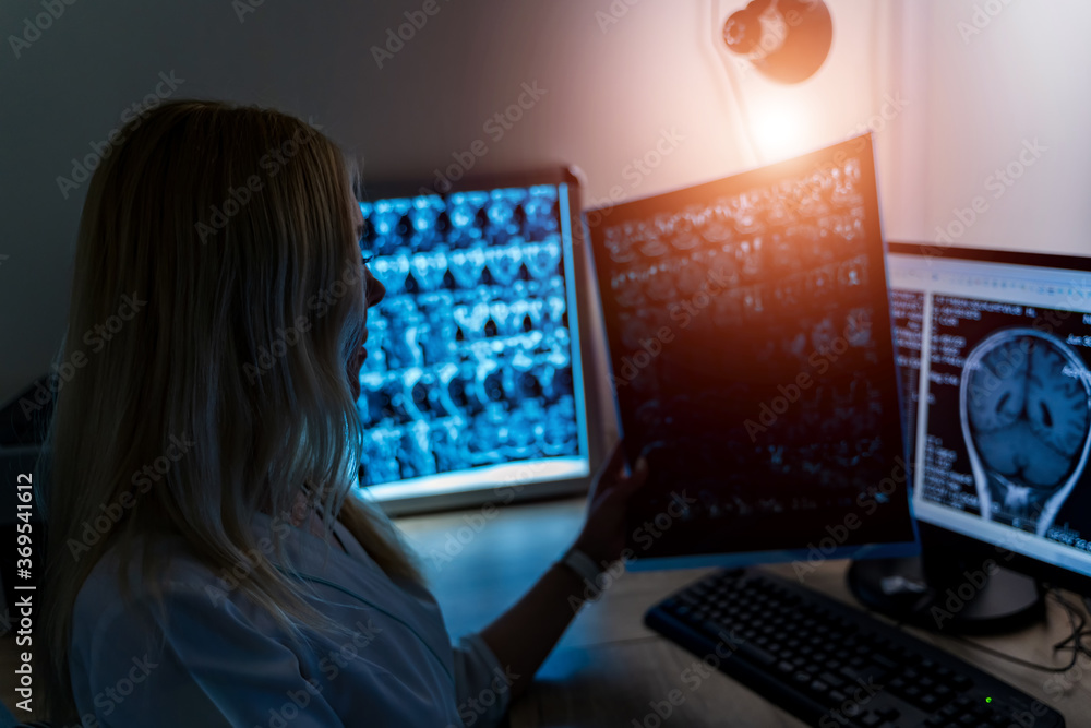 Doctor holding a picture of a brain MRI workflow in diagnostic hospital. Healthcare, roentgen, peopl