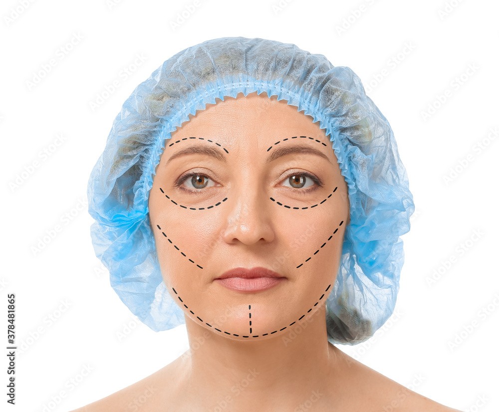 Mature woman with marks on her face against white background. Plastic surgery concept