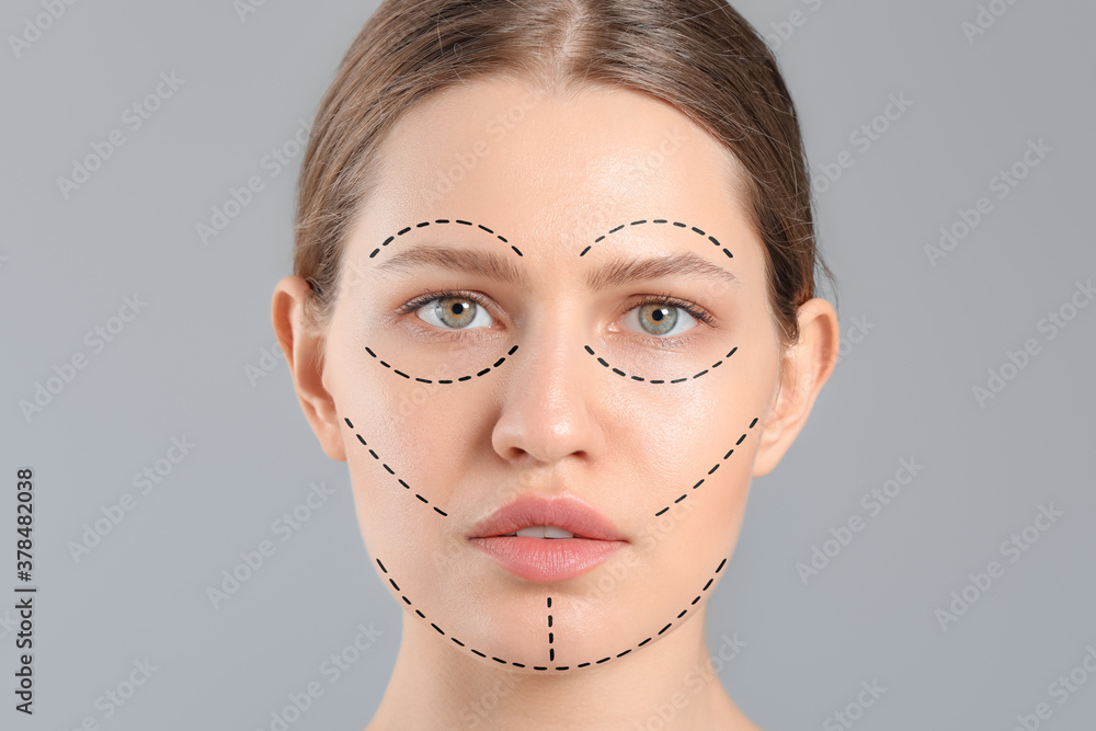 Young woman with marks on her face against grey background. Plastic surgery concept