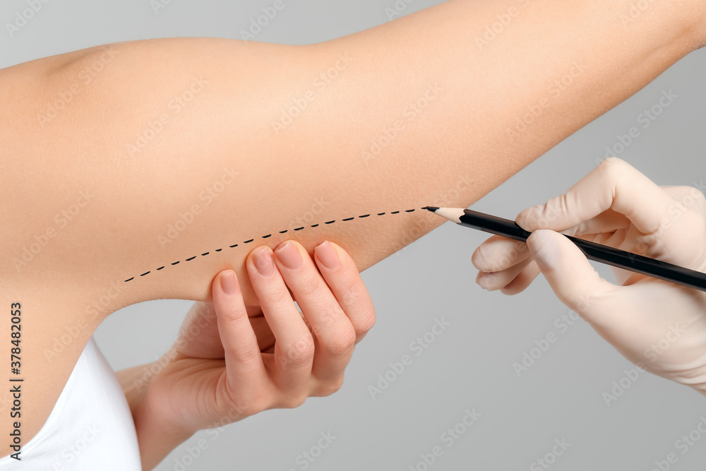 Plastic surgeon applying marks on womans body against grey background