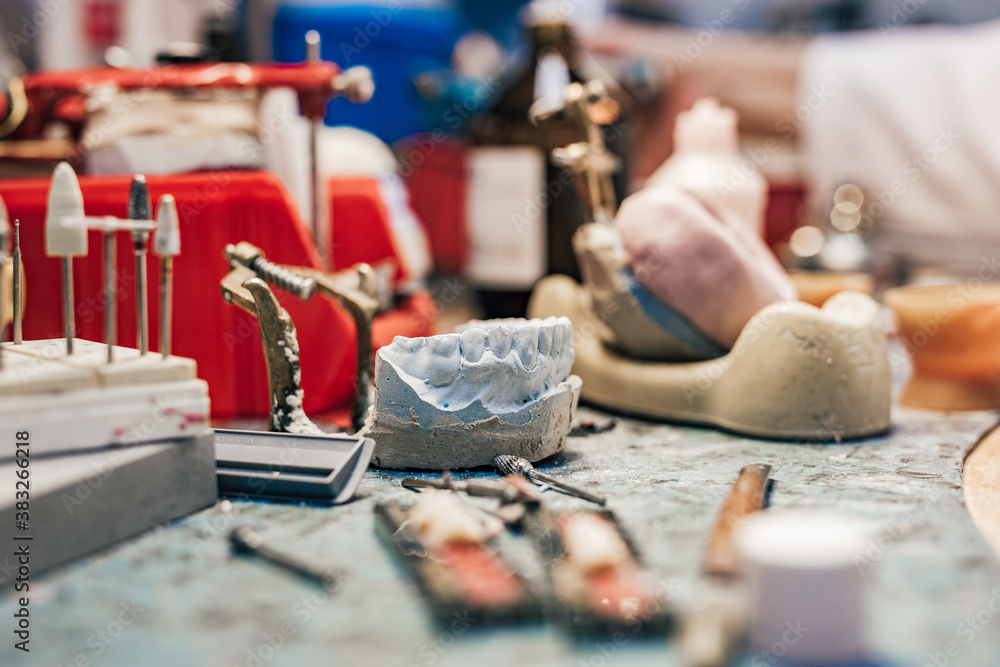 Orthodontist laboratory, close-up. Artificial jaws, burrs and other equipment on a table.