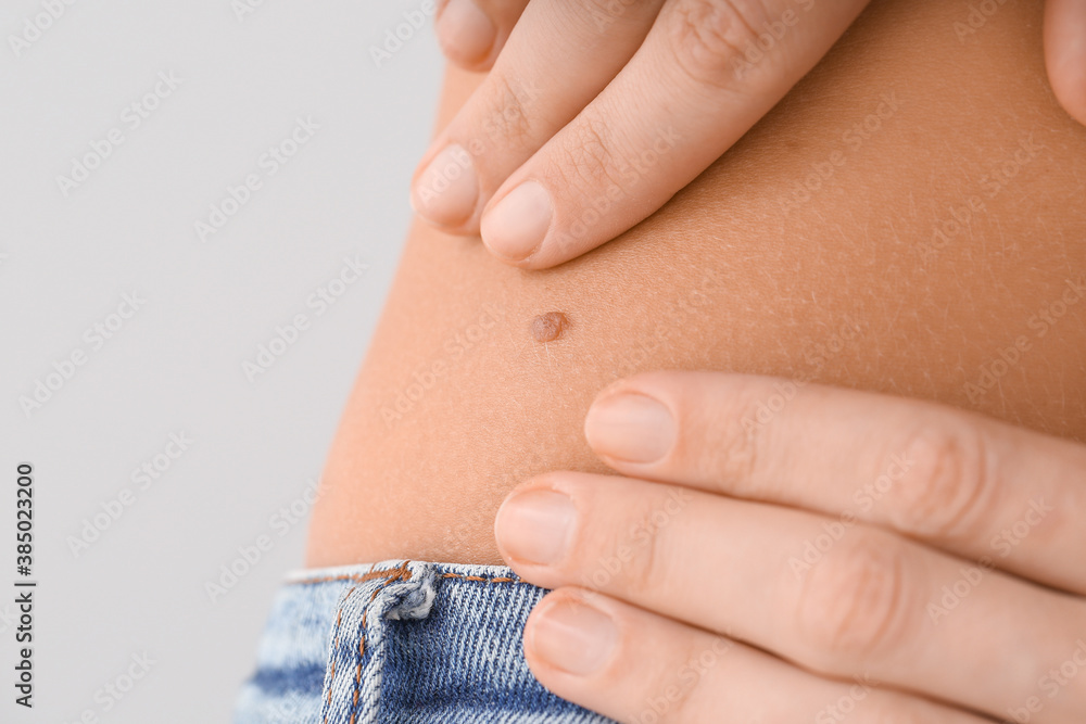 Dermatologist examining patient on light background, closeup