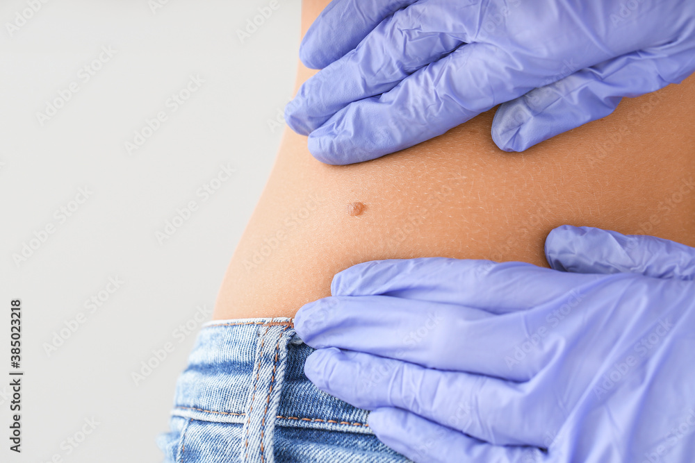 Dermatologist examining patient on light background, closeup