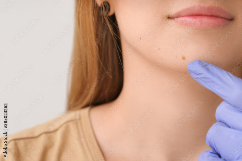 Dermatologist examining patient in clinic, closeup