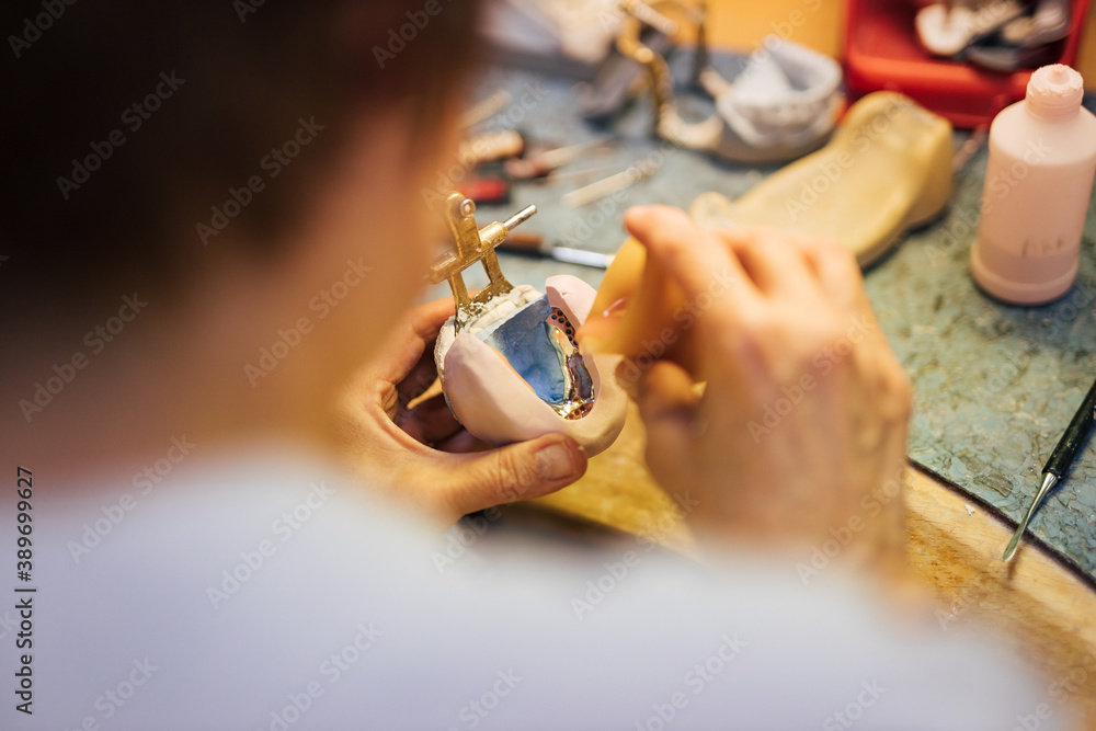 Dentist technician working on plaster copy of the jaw.