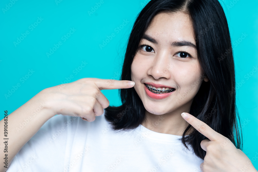 Asian woman wearing dental braces pointing to tooth sample and smiling with her healthy white teeth 