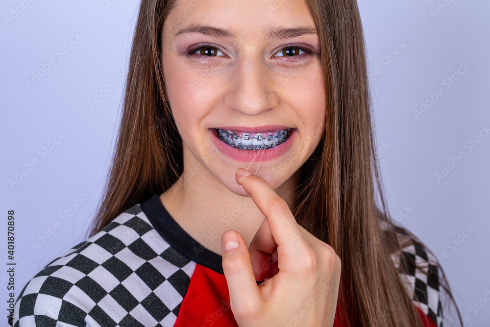 Teenager with smile shows white teeth with braces. white background.