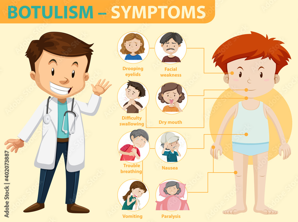 肉毒杆菌症症状信息图表