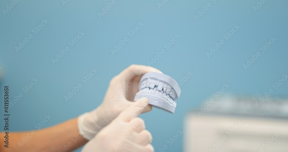 Dentist looking on a jaw model, modeling orthodontic treatment for a patient. Dentist working at the