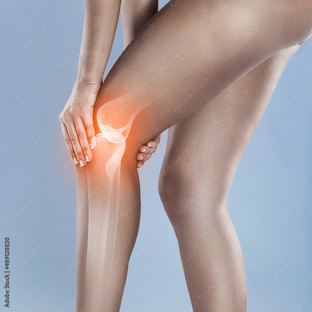 Knee injuries can linger. Concept shot of a woman with a painful knee joint.