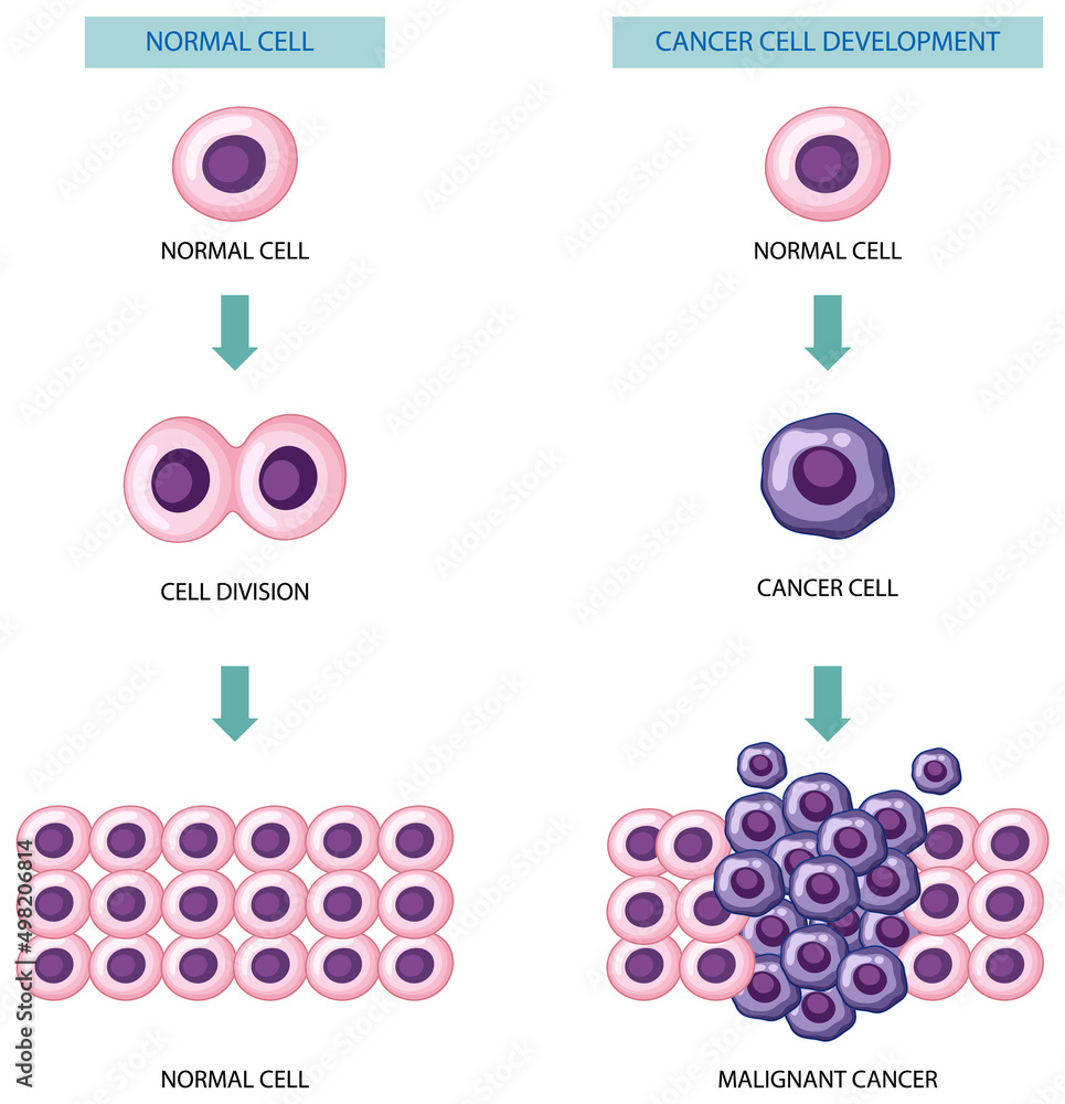 癌症细胞发育过程