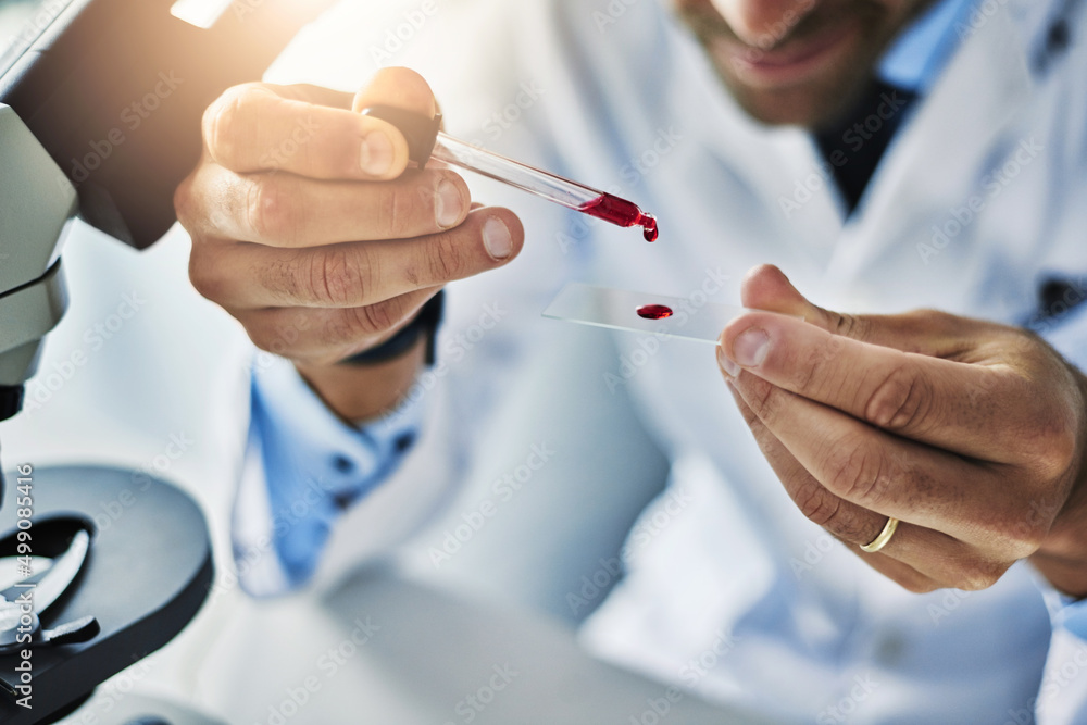 These will need further examining. Shot of a scientist analyzing medical samples in a lab.