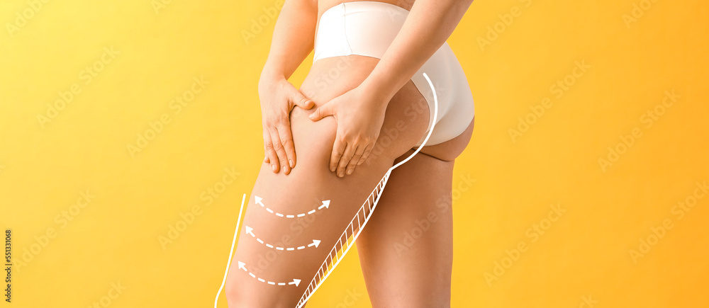 Young woman with cellulite problem on yellow background