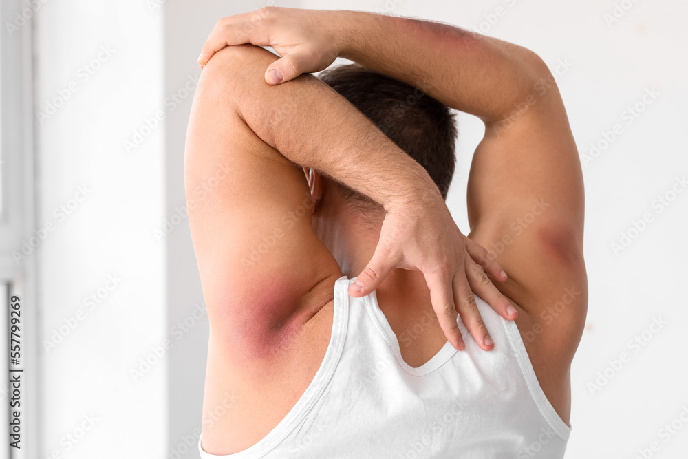 Sporty man with bruises on body training in gym, back view